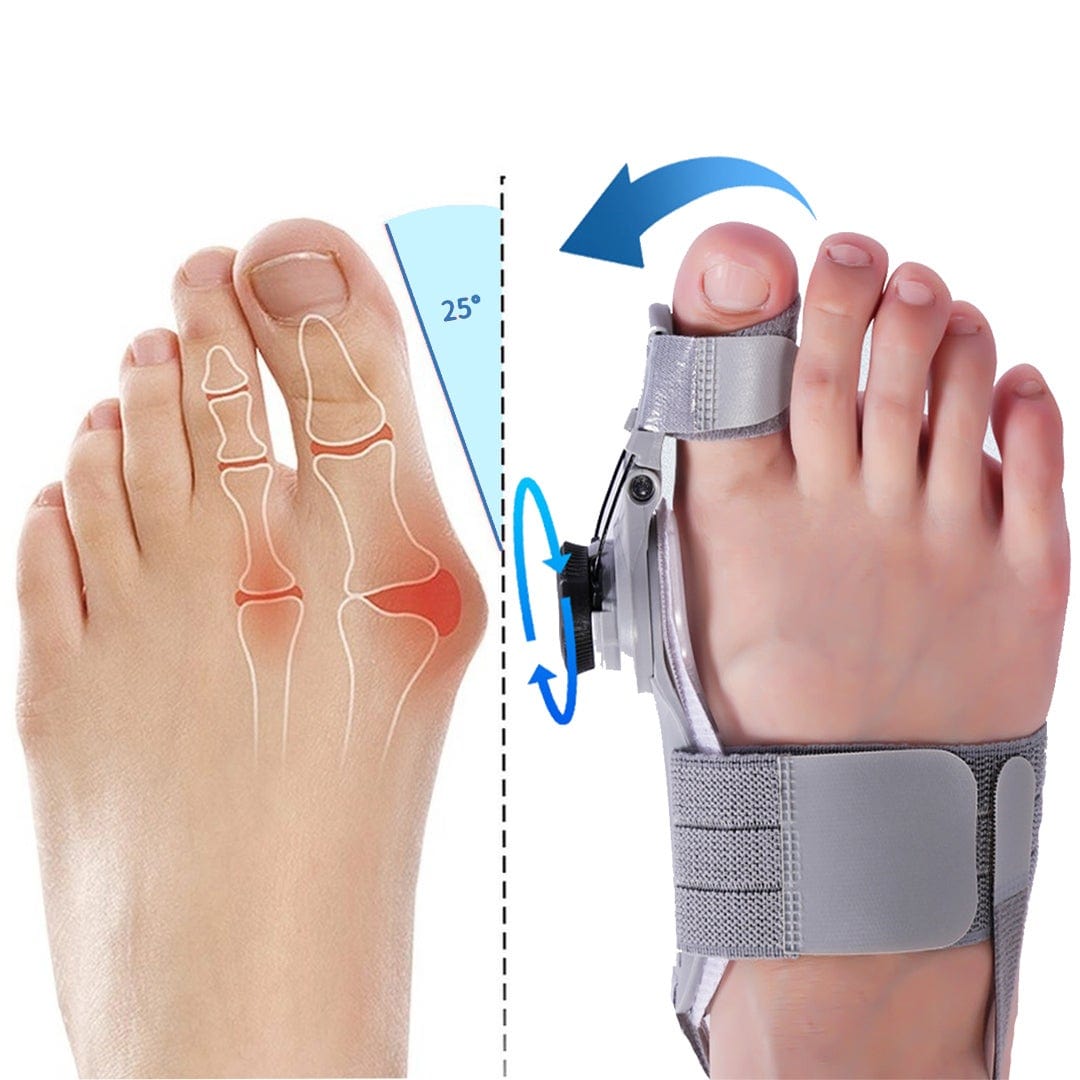 Stamny GRAY / CHINA Stamny™ Bunion Corrector